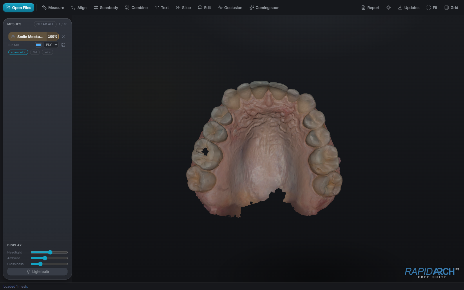 RapidArch FS showing a full-color upper-jaw intraoral scan in the dark theme
